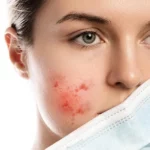 How is the pandemic affecting your skin?