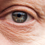 The Difference Between Fine Lines and Wrinkles: 2 Key Notes