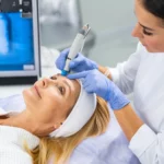 Achieve Radiant Skin: Microdermabrasion Treatment Guide