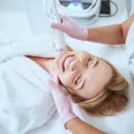 4 Amazing Benefits of Microneedling: Risks & Aftercare Tips