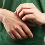 Skin Rash Types: How to Identify and Treat the 7 Most Common Kinds